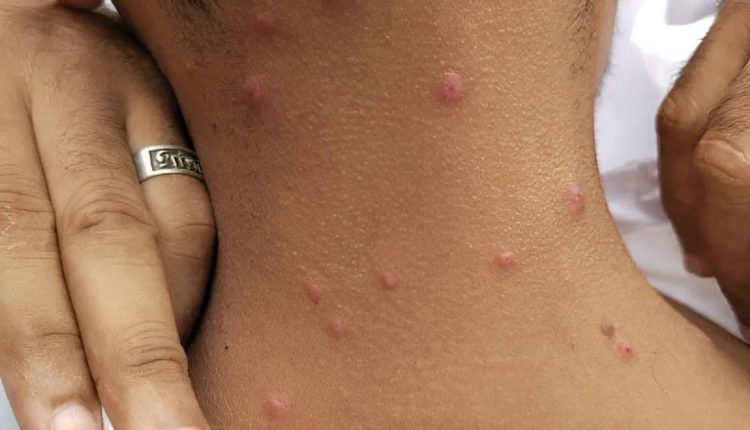 أمراض جلدية غريبة