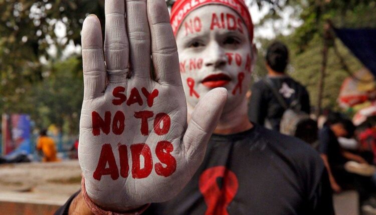 فيروس نقص المناعة البشرية (HIV)